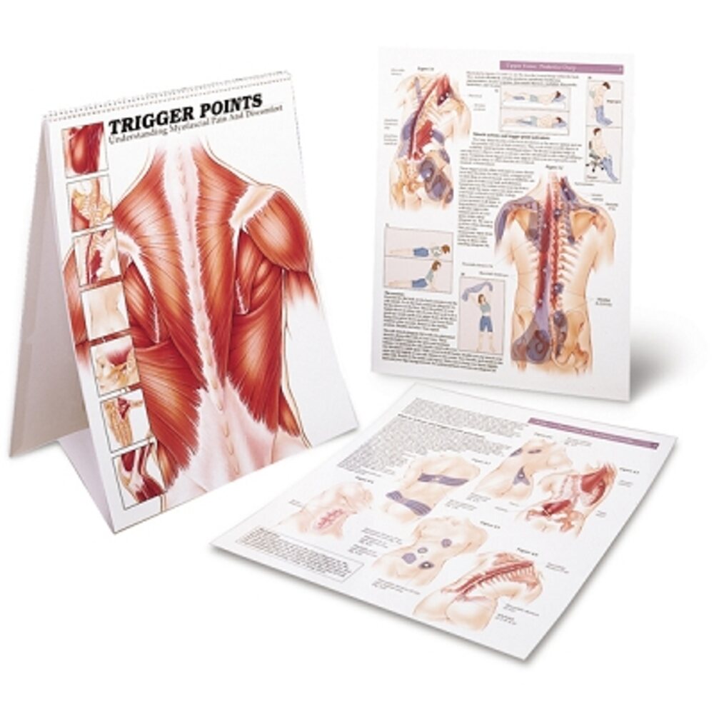 Trigger Point Desk Book - Myfascial Pain (573 0131