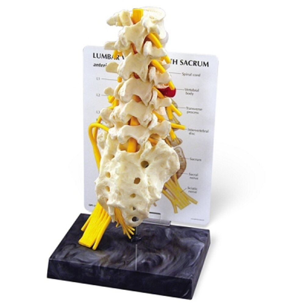5pc Lumbar Vertebrae & Sacrum Model with Key Card