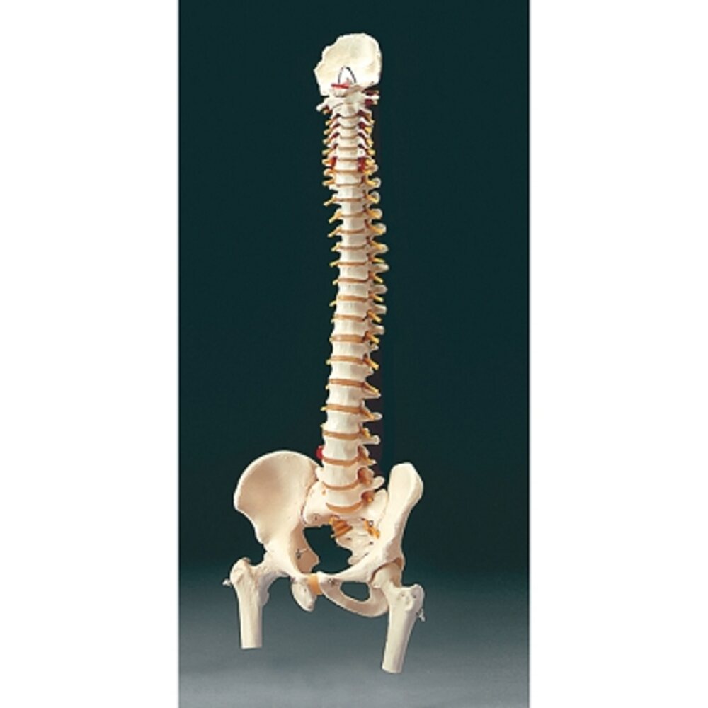 Vertebral Column And Femoral Heads 32